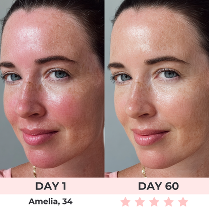 GlowVis™ - LED Face Mask