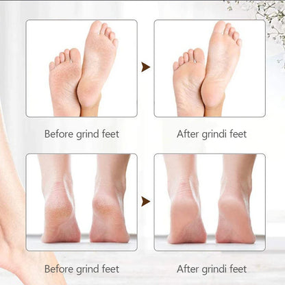 Smooth Foot Miracle Grinder